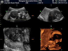 Vivian Sonograms